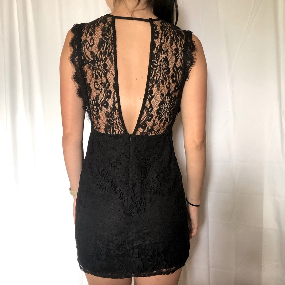 KIMCHI BLUE 🖤SCALLOP LACE BACKLESS DRESS